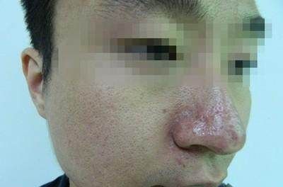 身体有这5个症状，说明肝脏出现问题了，一分钟自测