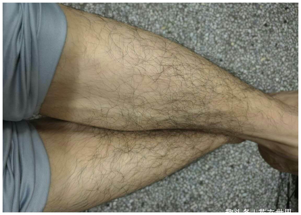 为啥有的男孩子腿毛旺盛,有人却"光溜溜"?89%因三点不