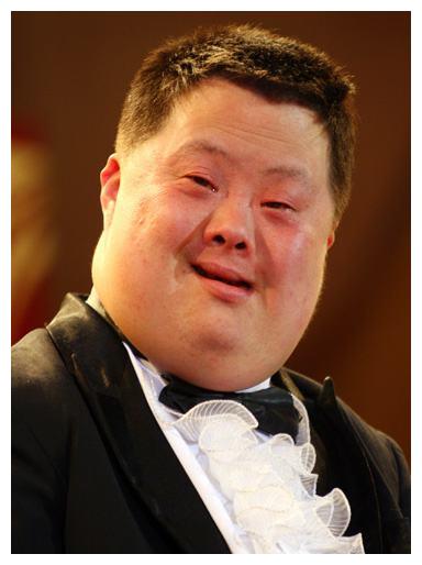 脑瘫天才指挥家舟舟风光不再心智依旧是个孩子