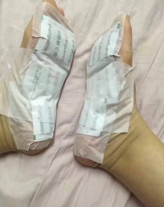 如何用外治的方法祛除体内的湿气和寒气