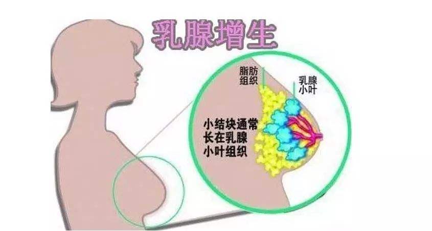 中医怎么治疗乳腺增生，治疗乳腺增生的办法有吗