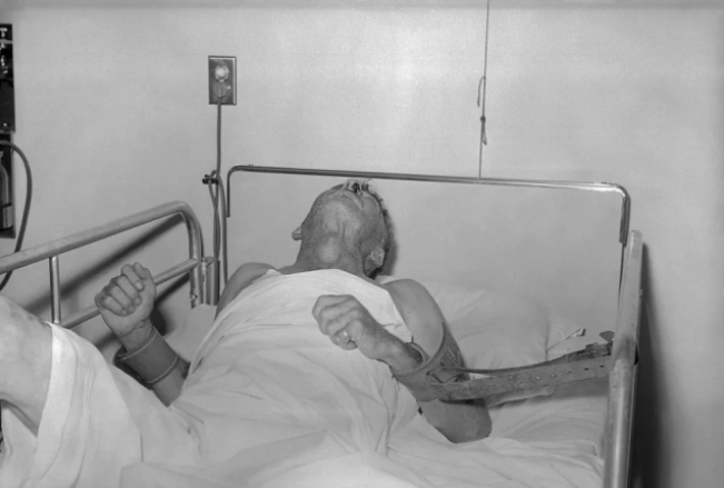 男童被黑狗扑咬，四针狂犬疫苗后仍病发离世，究竟是什...