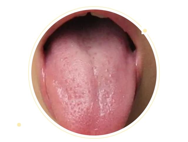 生化阴血的功能减退 推动血液运行之力减弱 以致血液不能营运于舌中
