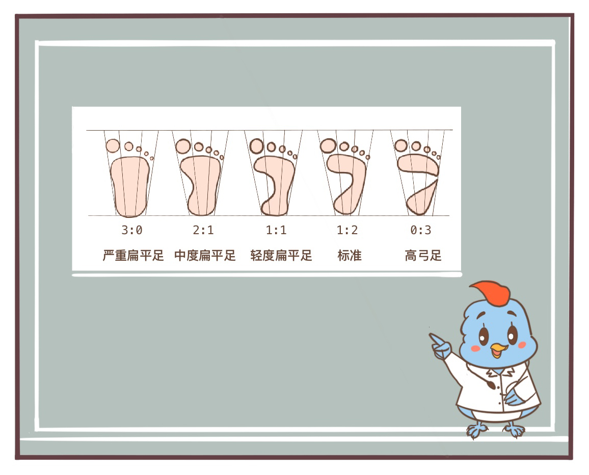 一幅漫画了解扁平足的危害及防治方法