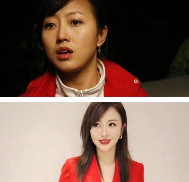 潘长江女儿潘阳被指整容,金发红唇变化太大,而鼻梁最让人关注
