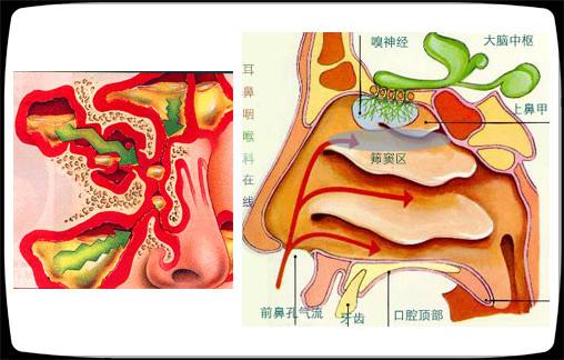 上颌窦炎不能吃什么？|上颌窦炎|头痛|粘膜_新浪网