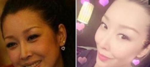 曾比那英更出名, 被曝包养黄晓明, 如今却因整容被骂!