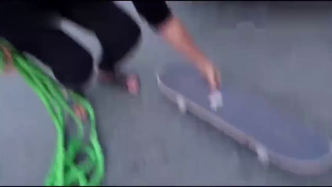 超级跑车的起步速度有多快，小伙第二天就住院了