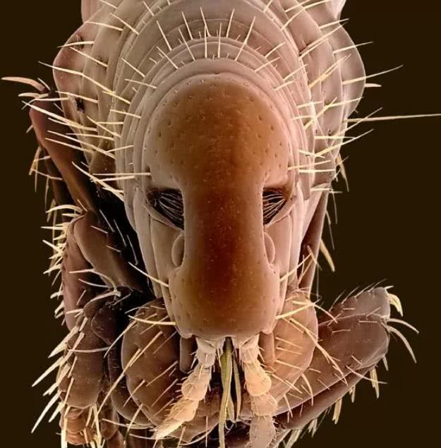 8张1600倍显微镜下的寄生虫高清图看完感觉身上有点儿痒痒