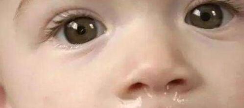 刚满2岁的宝宝,感冒咳嗽流鼻涕真苦恼,妈妈们应该掌握