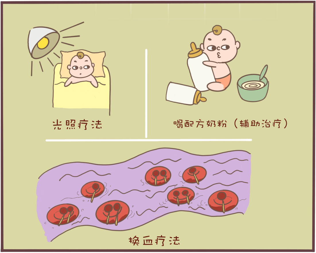 一幅漫画教你轻松辨别生理性黄疸和病理性黄疸|黄疸|生理性|病理性_新浪新闻