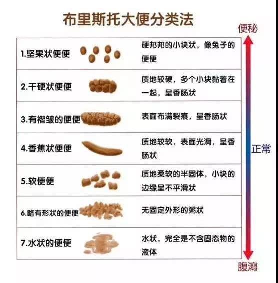 英国布里斯托的两位学者,西顿和路易斯率先发明了布里斯托大便分类法