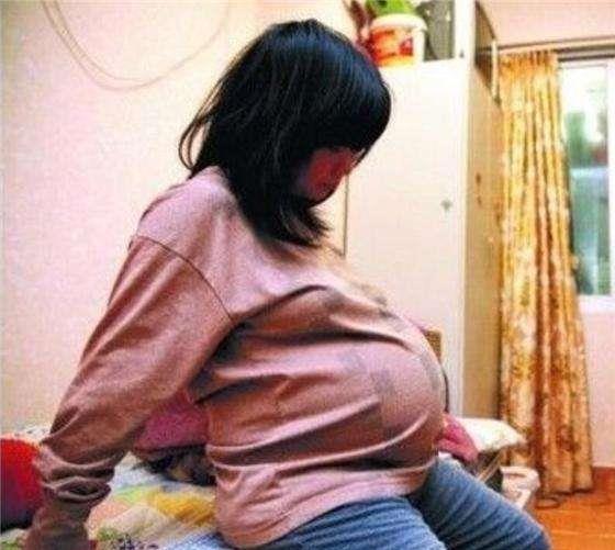 怀孕2个月的时候,张女士的肚子就比较显孕了,刚开始以为是没工作了长