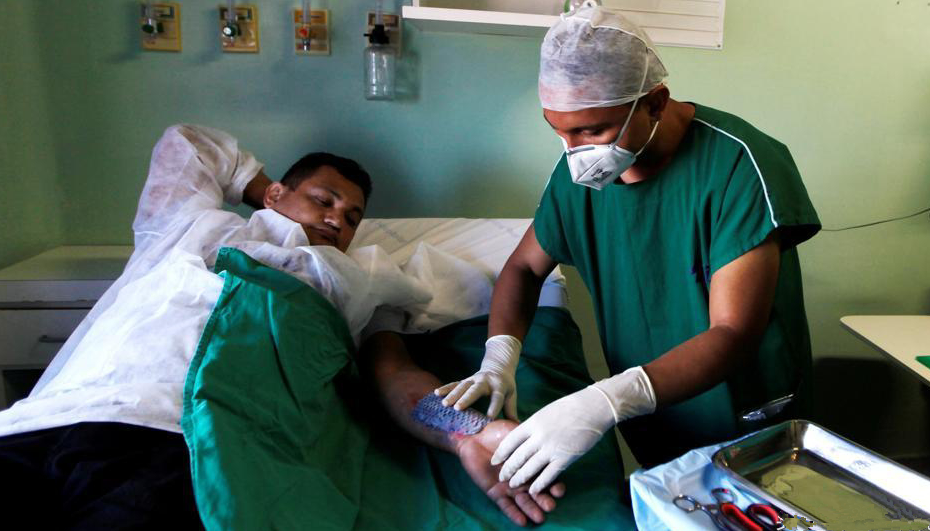 医生治烧伤用“鱼皮”，啥药也不用，愈合快效果好鱼愈合罗非鱼_新浪新闻