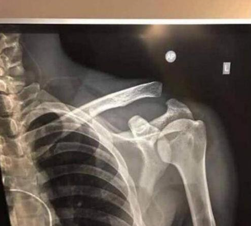 武磊到底牺牲了多少?沪媒披露武磊最新伤情,我