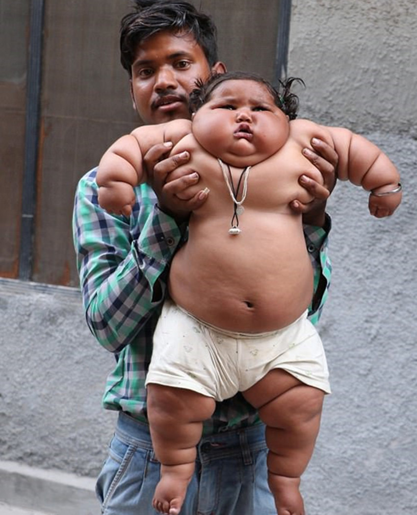 印度肥胖女童:年仅1岁的她快要吃穷父母,父母对她又爱