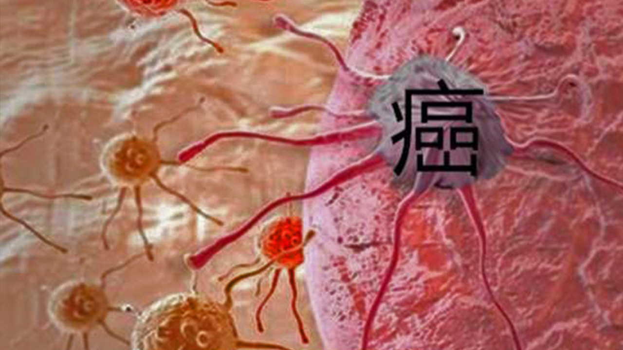 当癌症患者死后,人体里的癌细胞还能存活吗?