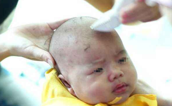 四个月的宝宝不长头发,竟是因为婆婆将迷信,医