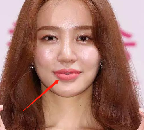尹恩惠的脸是整容过度吗，你怎么看？