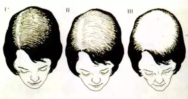 脱发这道题,太难了我不会答.