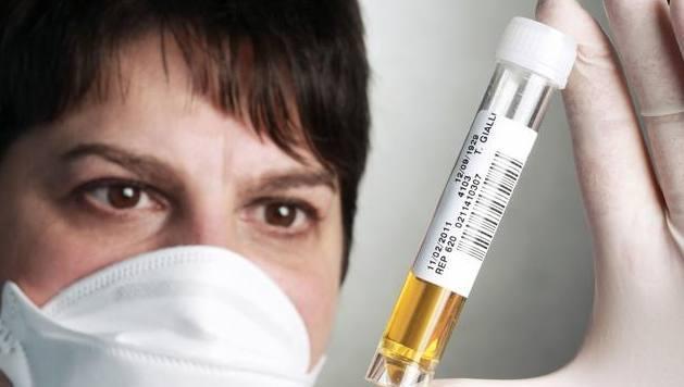 女人尿尿时,发现尿液很黄?这5种情况,都会导致