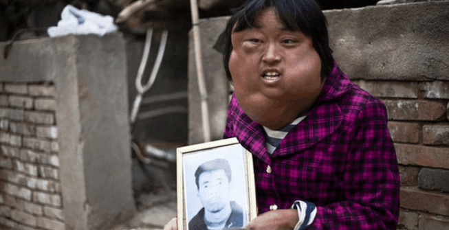 女子生病变丑妇, 和狗相依为命