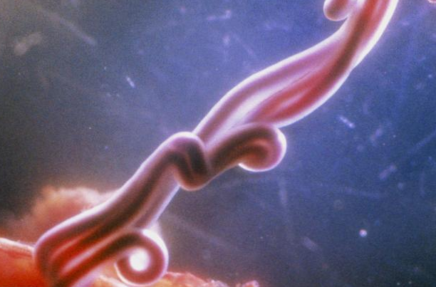 脐带血和脐带是有区别的 专家提倡同时保存