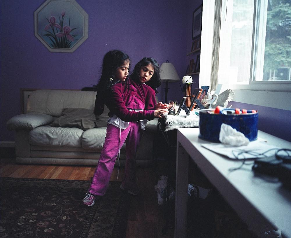 美国惊现双头人, 她曾被预言活不过三天, 现在却