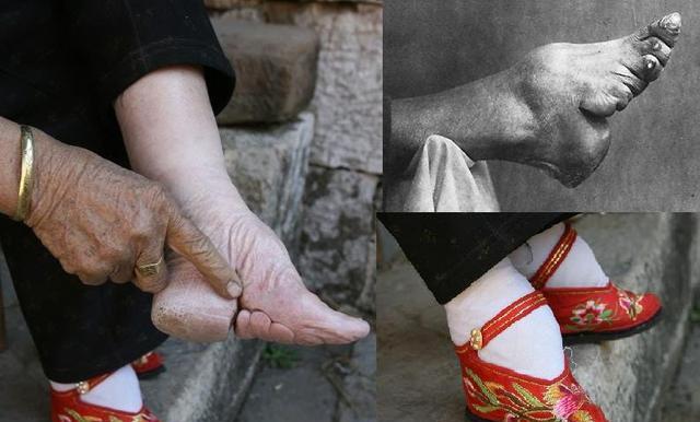 小脚妻三寸金莲图片