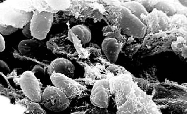 日军撤离东北时做了什么? 人吃着饭, 突然就口