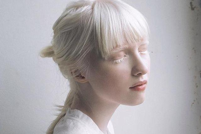 乌克兰一女子患白化病,全身雪白,却凭借异样的美成知名模特!