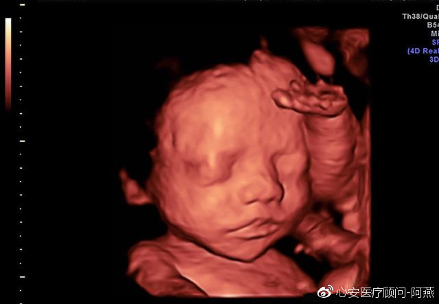 24周胎宝宝有多大图片,16周的宝宝有多大图片 怀孕24周去医院做四维,医生看到宝宝表情后,痛骂孕妈不自爱
