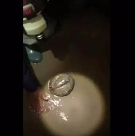 男子夜晚去到河沟捉野外,却被不明物咬伤,抓起