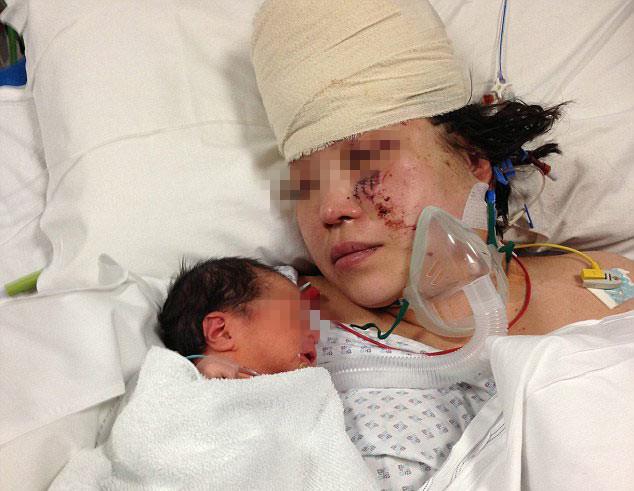 她怀孕即将临产,醒来看到自己的大肚子没了,孩