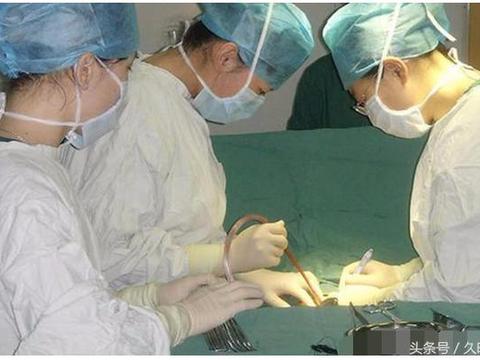 引产费用报销情况 引产手术能报多少钱