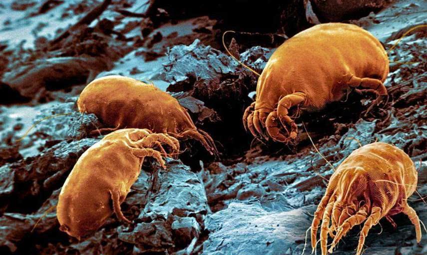 皮肤长痘长疹子,可能是床单太脏!3招教你高效杀灭螨虫!试试吧