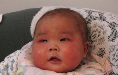 滚滚鸡蛋就能去胎毒? 宝宝刚出生, 婆婆就要