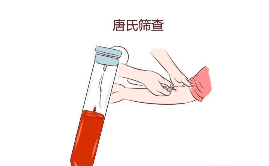 唐筛高危, 羊水穿刺要不要做?