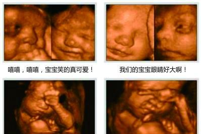王祖蓝晒女儿四维照片，胎宝宝四维照片这么丑，你能接受吗