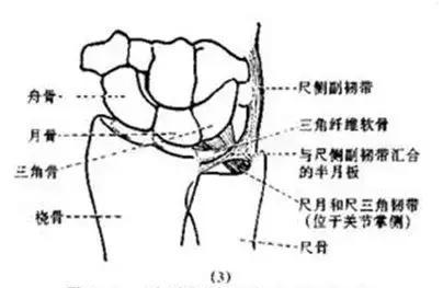 手腕撑地疼?不能拧毛巾?你知道是因为什么吗?