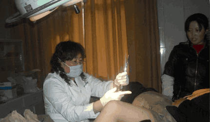 一胎后被丈夫强逼上环, 如今要二胎, 取环吓坏医生!