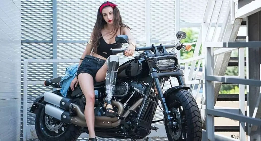18歲的意大利最美「獨腿天使」，活得自信比什麼都重要！