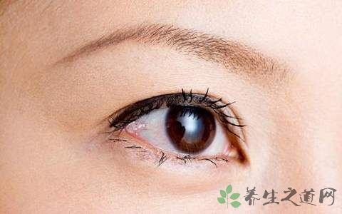 怀疑类风湿需要做哪些检查