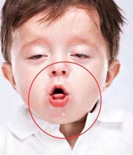 这样做可以帮助宝宝快速化痰, 效果非常快, 很多