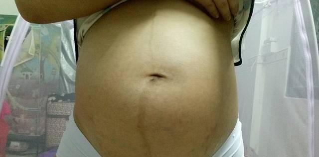 38 2顺产男宝,分享怀男宝肚型及症状