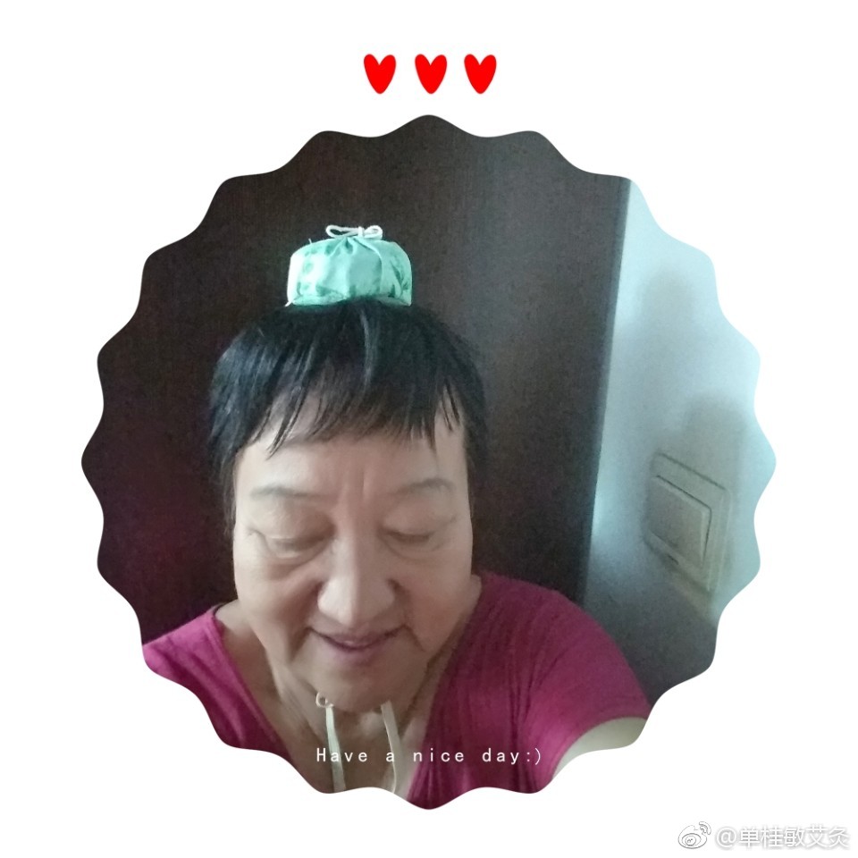 脑萎缩是老年痴呆的发展过程