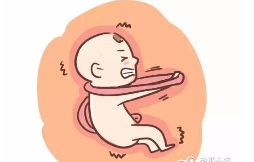 男宝脐带绕颈更常见? 这事居然分男女? !