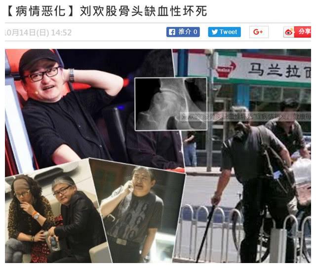 歌手刘欢近日病情曝光，身体每况愈下