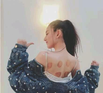 宋祖儿微博晒出后背少女字体,照片:拔罐初长成连笔网友女生图片