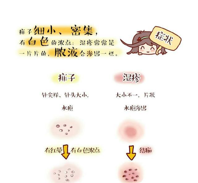 痱子和湿疹的区别图片痱子和湿疹图片对照